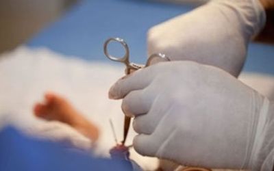 Circumcision Facts, Pros, Cons, and Risks – What You Need to Know